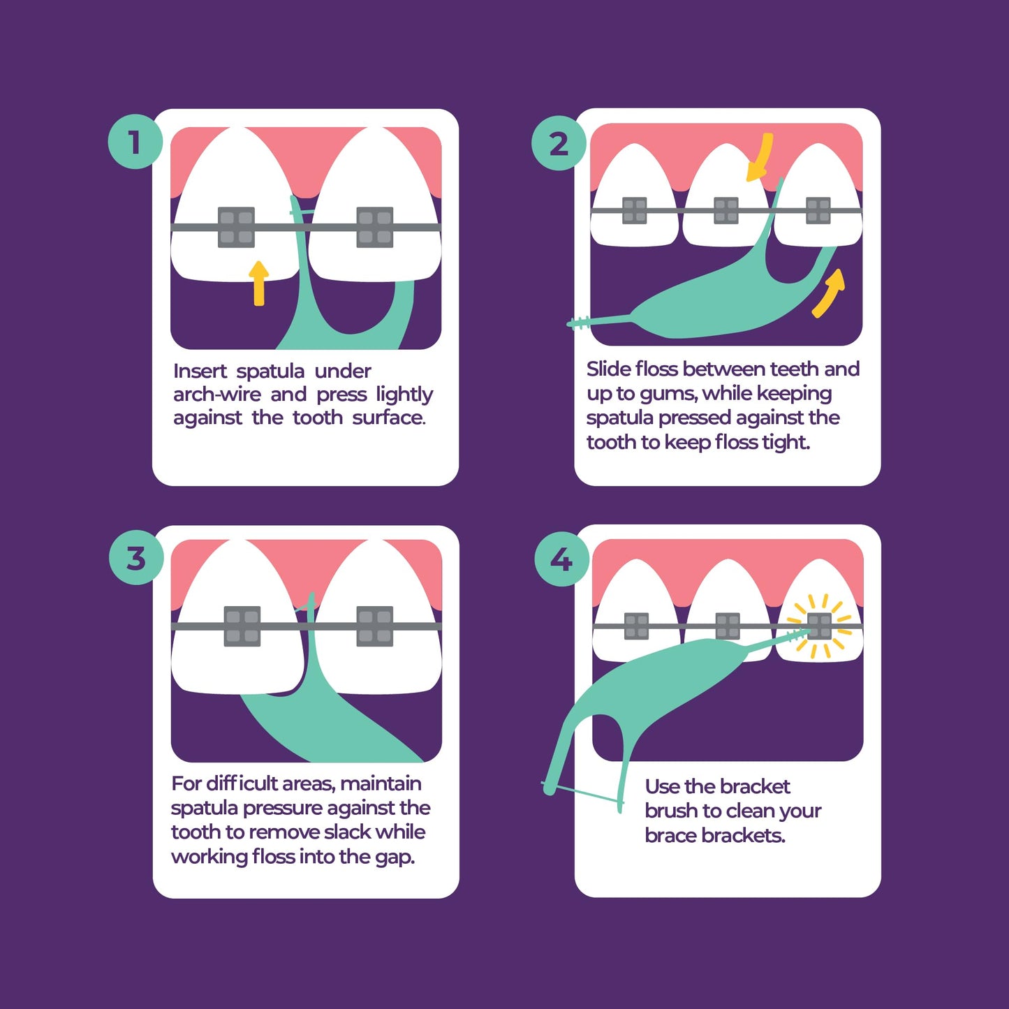 Platypus Orthodontic Flossers for Braces, 40 Count (Pack of 3), Ortho Picks for Adults & Kids, Fits Under Arch Wire, Non-Damaging, Encourage Flossing Habits